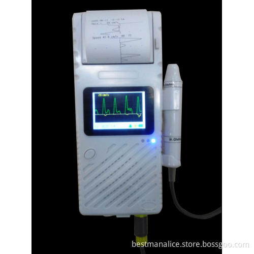 ultrasound doppler